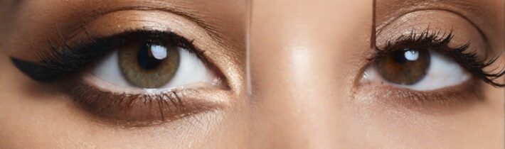 How To Erase Your Dark Circles—Top Concealers + Expert Tips