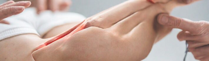 Could Fascia Manipulation Be The Next Big Thing In Pain Relief?