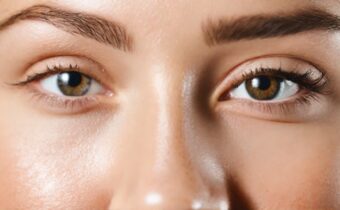 Eye Spy: 7 Natural Ways to Erase Under-Eye Circles
