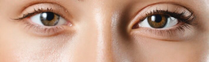 Eye Spy: 7 Natural Ways to Erase Under-Eye Circles