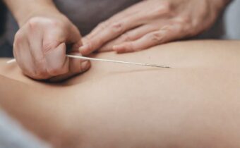 NYC’s Leading Acupuncturist Explains How Getting Needled Can Help You Get Pregnant
