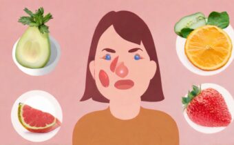 Foods That May Trigger Rosacea Flare-Ups