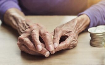 Managing Rheumatoid Arthritis on a Budget: Tips and Resources