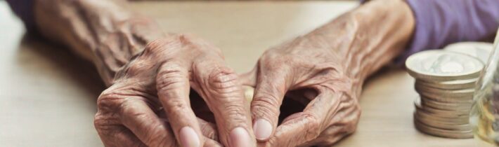 Managing Rheumatoid Arthritis on a Budget: Tips and Resources