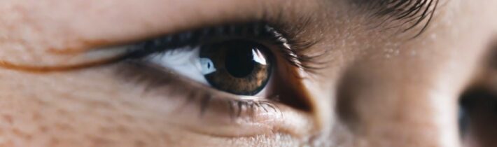 Understanding Genetic Dark Circles and How to Address Them