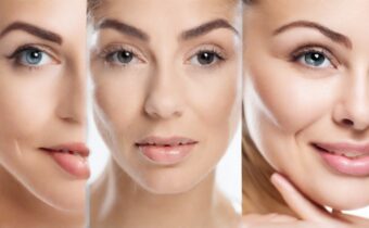 Why Juvederm Fillers is So Popular