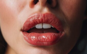 How to Take Care of Chapped Lips