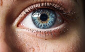 66. Skin Care Solutions for Itchy Eyes