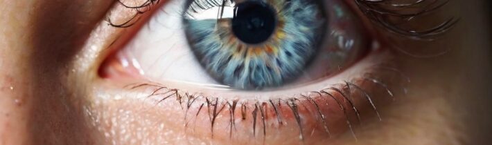 66. Skin Care Solutions for Itchy Eyes