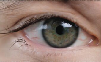 Combat Eye Exhaustion Naturally