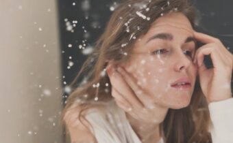 Best Dandruff Solutions