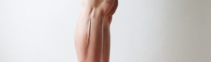 Height and Varicose Veins