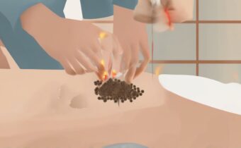 Moxibustion Benefits Explained
