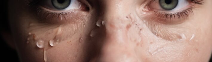 StriVectin Under-Eye Solution