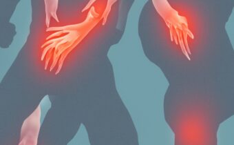 Common Causes of Hip Pain