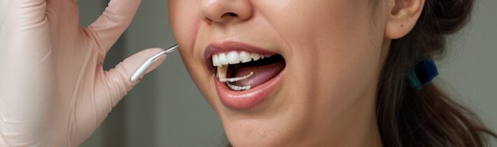 Consequences of Skipping Dental Checkups