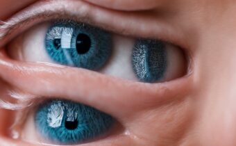 Demodex Mites and Eye Irritation