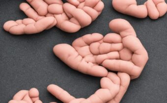 How to Remove Calluses