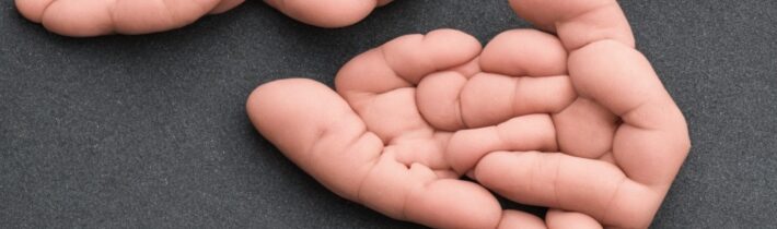 How to Remove Calluses