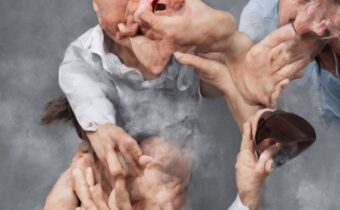 Managing Extreme Gas Pain