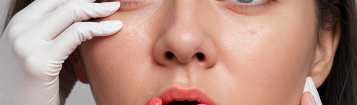 Mighty Patch Nose Treatment Guide