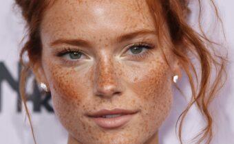 Celebrity Freckles Trend