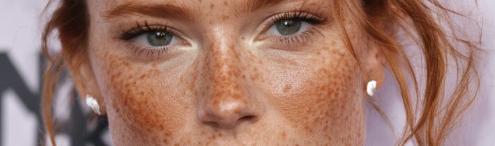Celebrity Freckles Trend