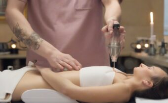 Cupping Therapy in NYC