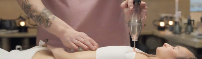 Cupping Therapy in NYC