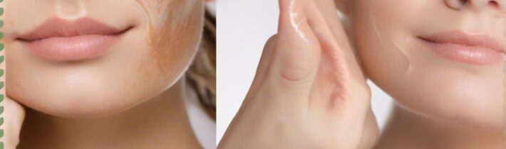 Smoother Skin Solutions