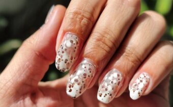 Understanding Leukonychia: Those White Spots on Your Nails