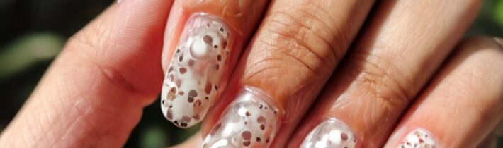 Understanding Leukonychia: Those White Spots on Your Nails