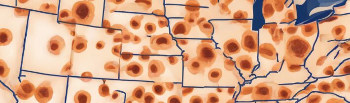 Skin Cancer Rates Across States